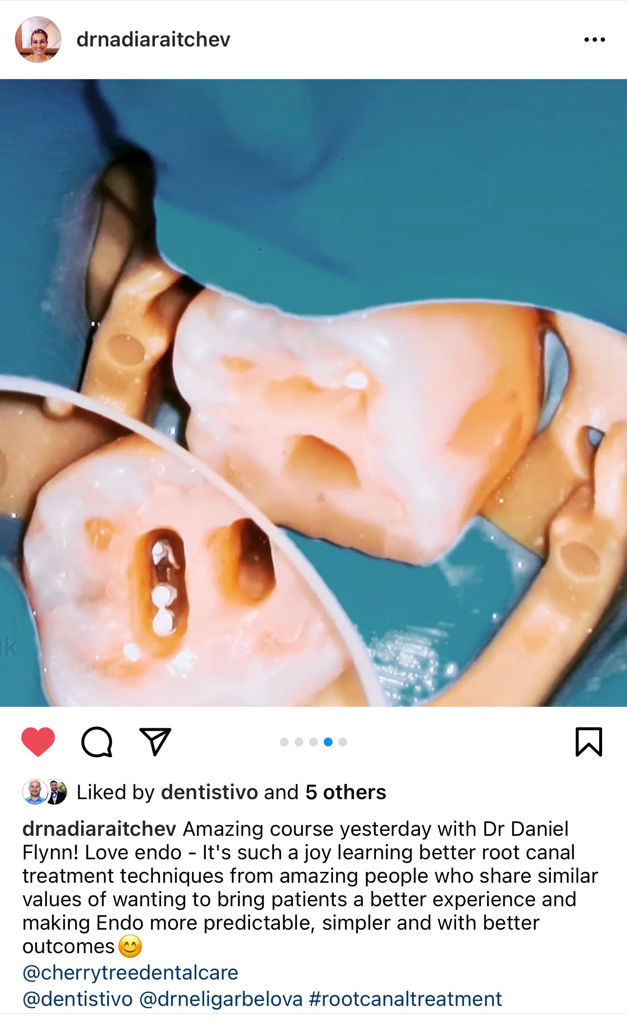 Finding canals, mb2 and other challenging canals