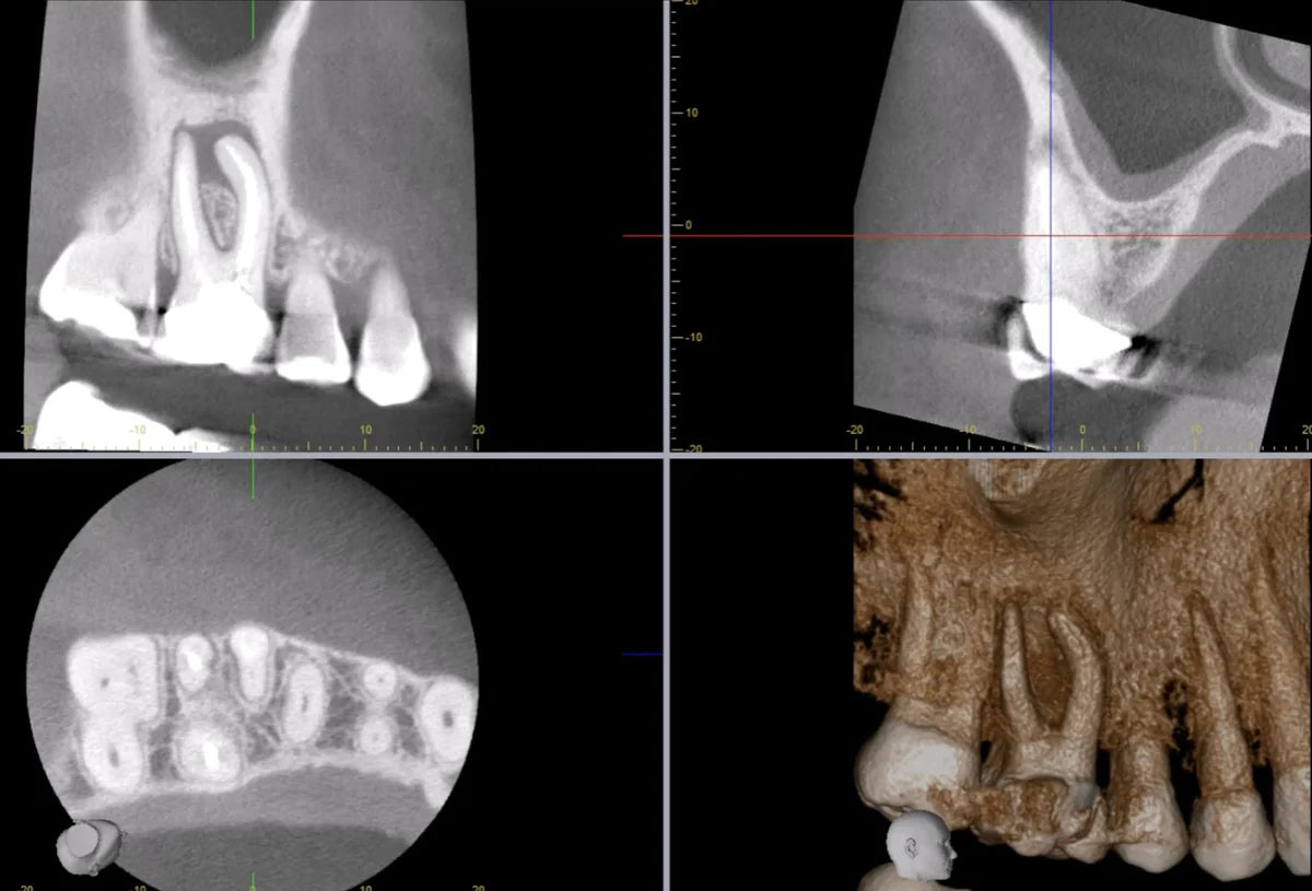 CBCT Course- Level 1 & 2 with emphasis on Endodontics- December 2025