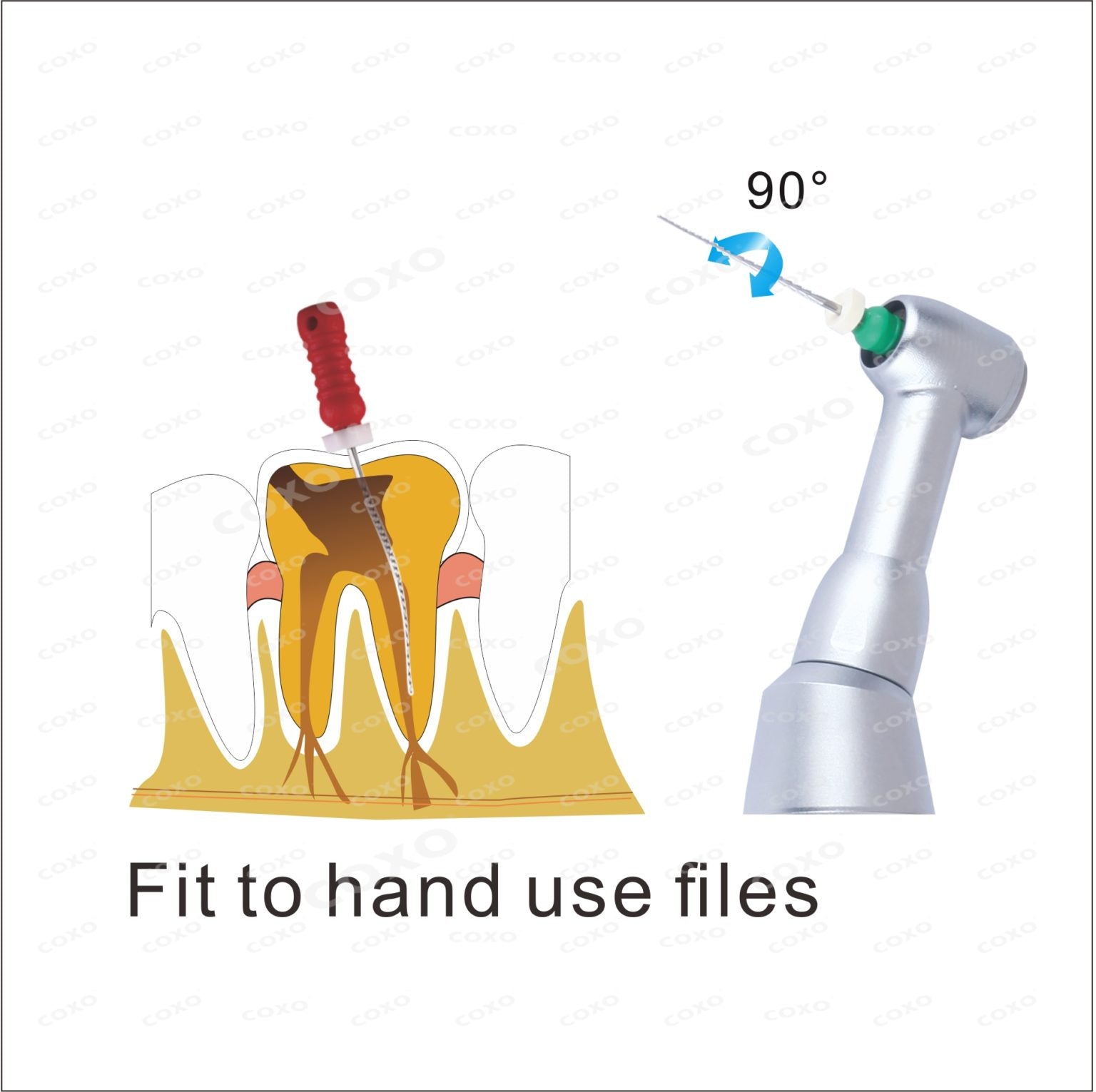 10:1 Hand file contra-angle handpiece with 30 degree reciprocation for negotiation of complex anatomy.