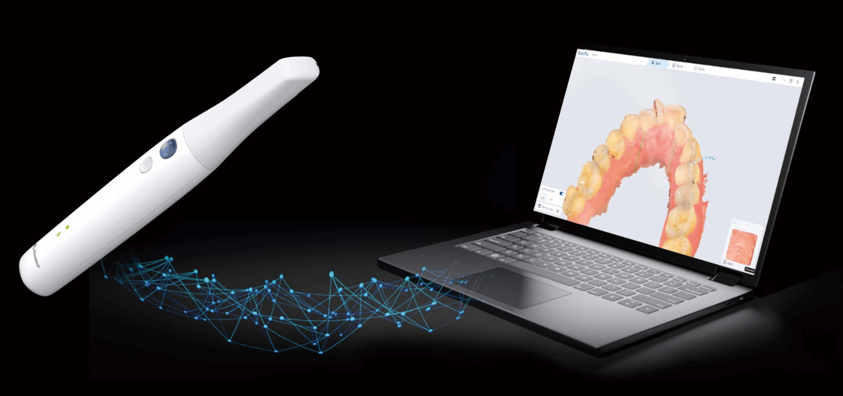 Intraoral Scanners by Alliedstar