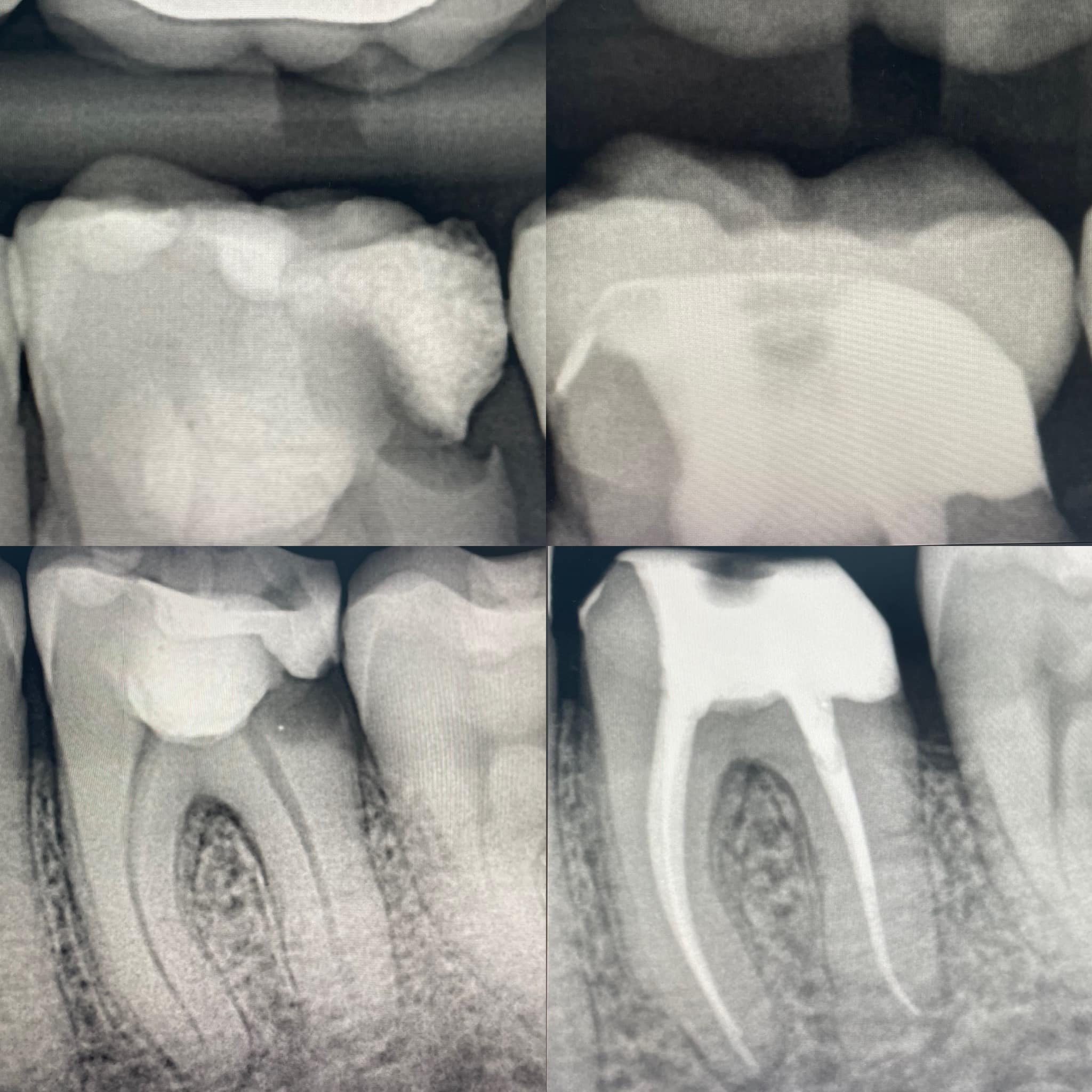 Endo-Resto with Dr Thomas Taha & Dr Daniel Flynn
