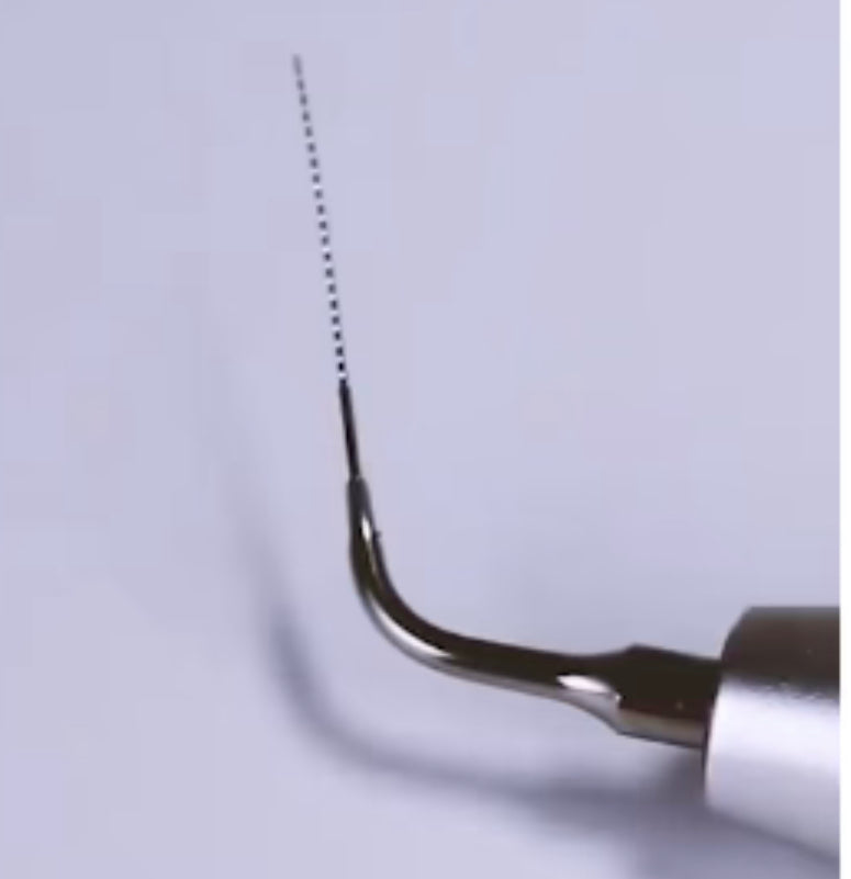 Ultrasonic Tips & Kits- DTE/S/N compatible