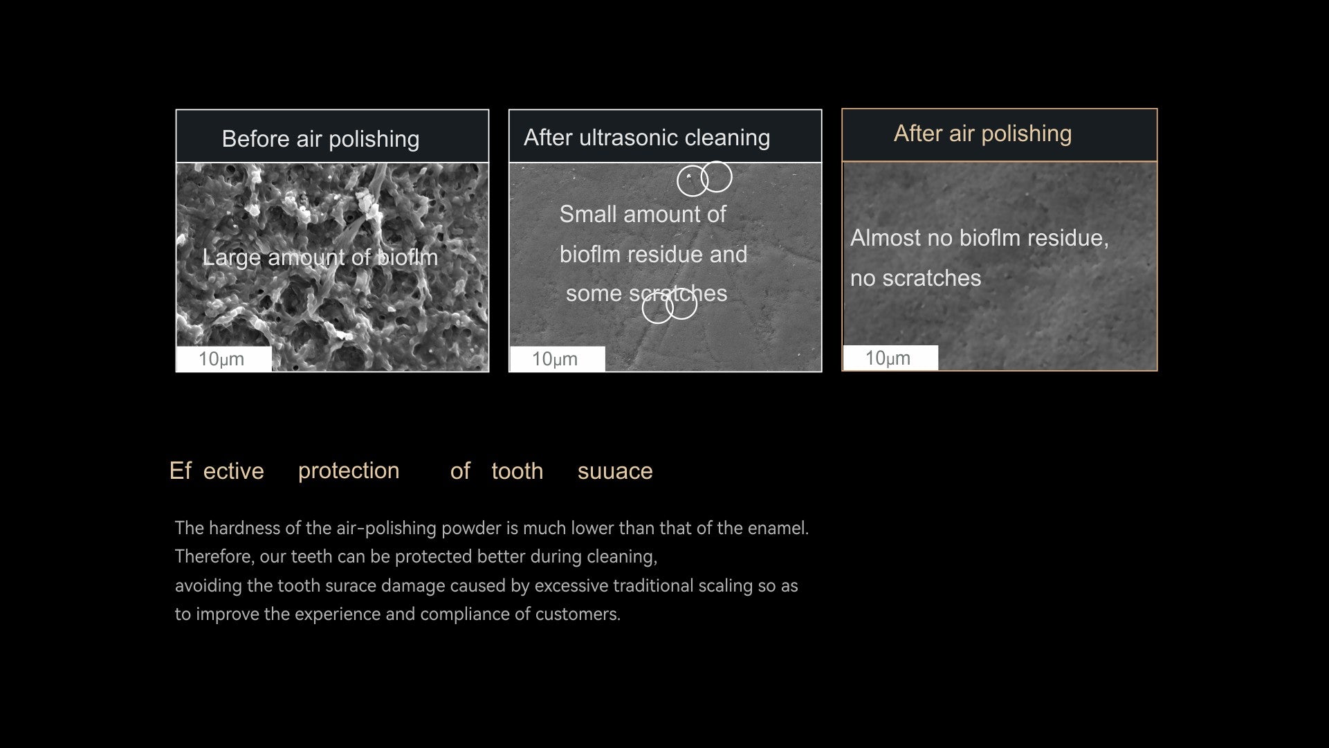 AP-H Plus- Dental airpolisher Woodpecker supragingival and subgingival