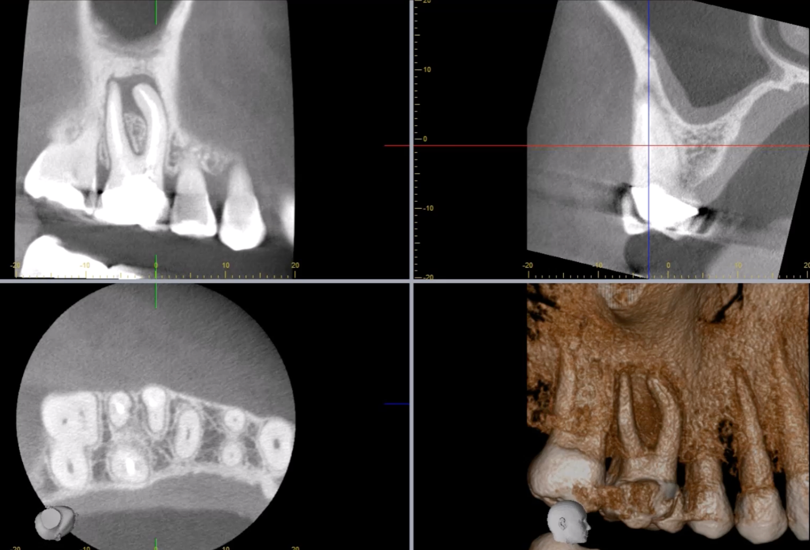 CBCT course level 1 & level 2 with emphasis on endodontics6th & 7th S