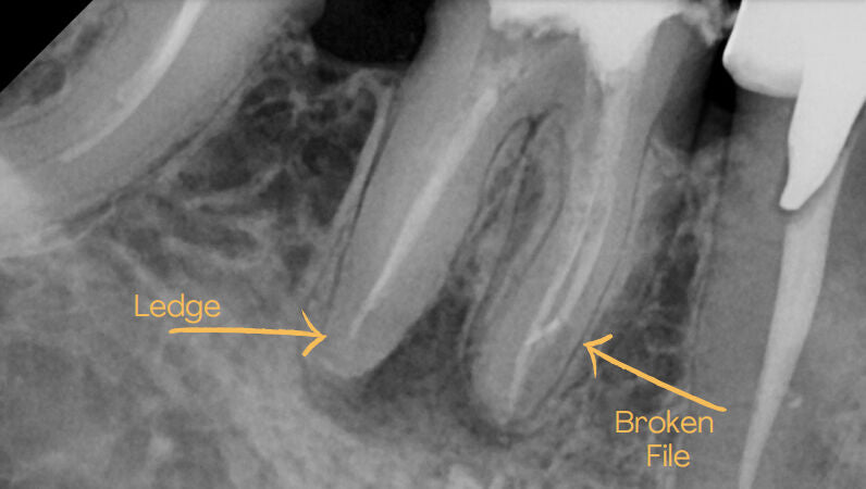 Removing broken files using Ultrasonics