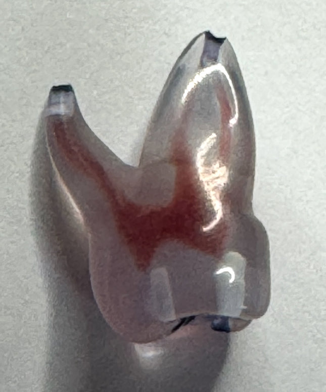 How do i find the canals in endodontics? Tips and tricks