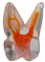 3D teeth
