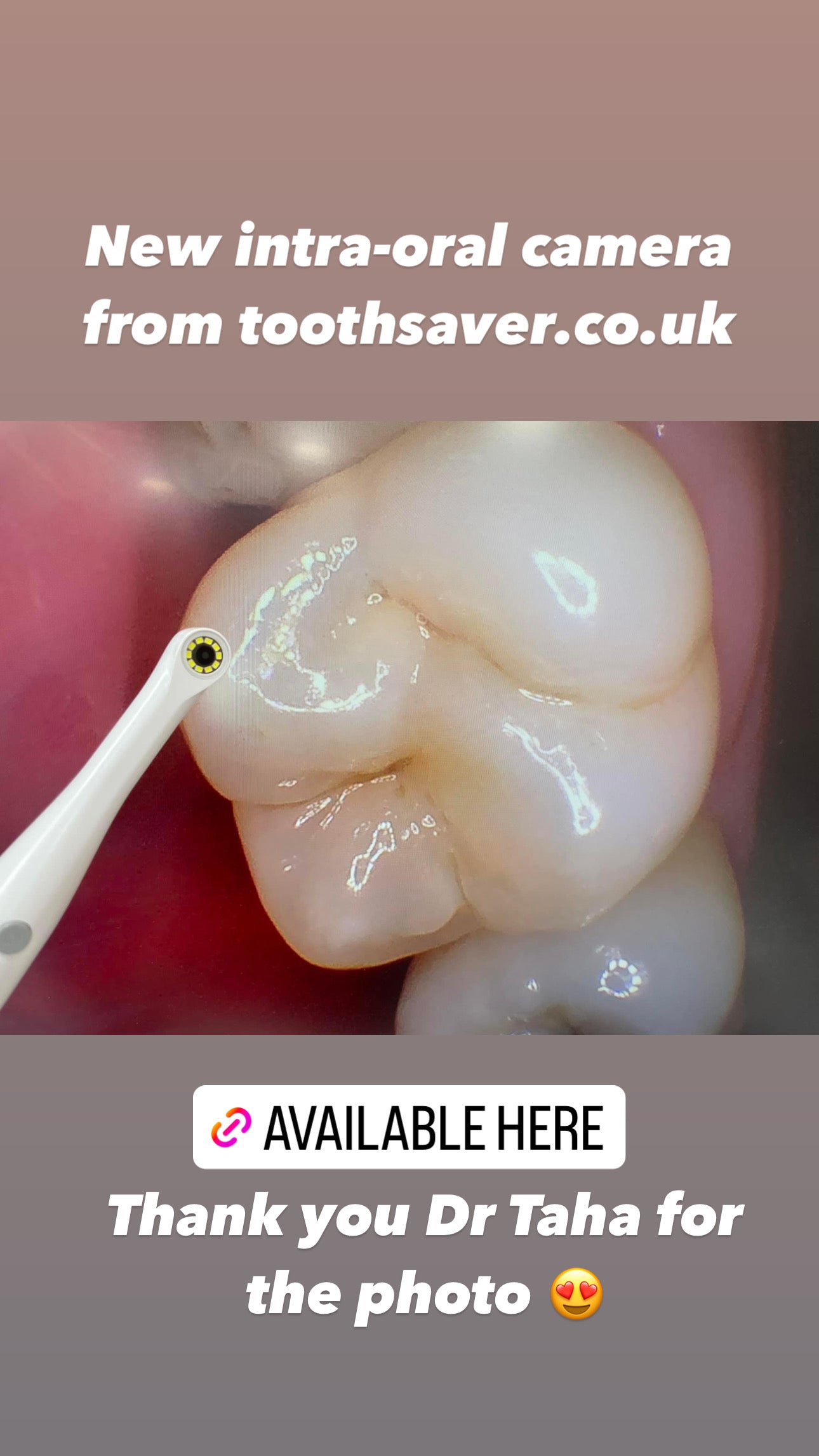 Intra-oral camera