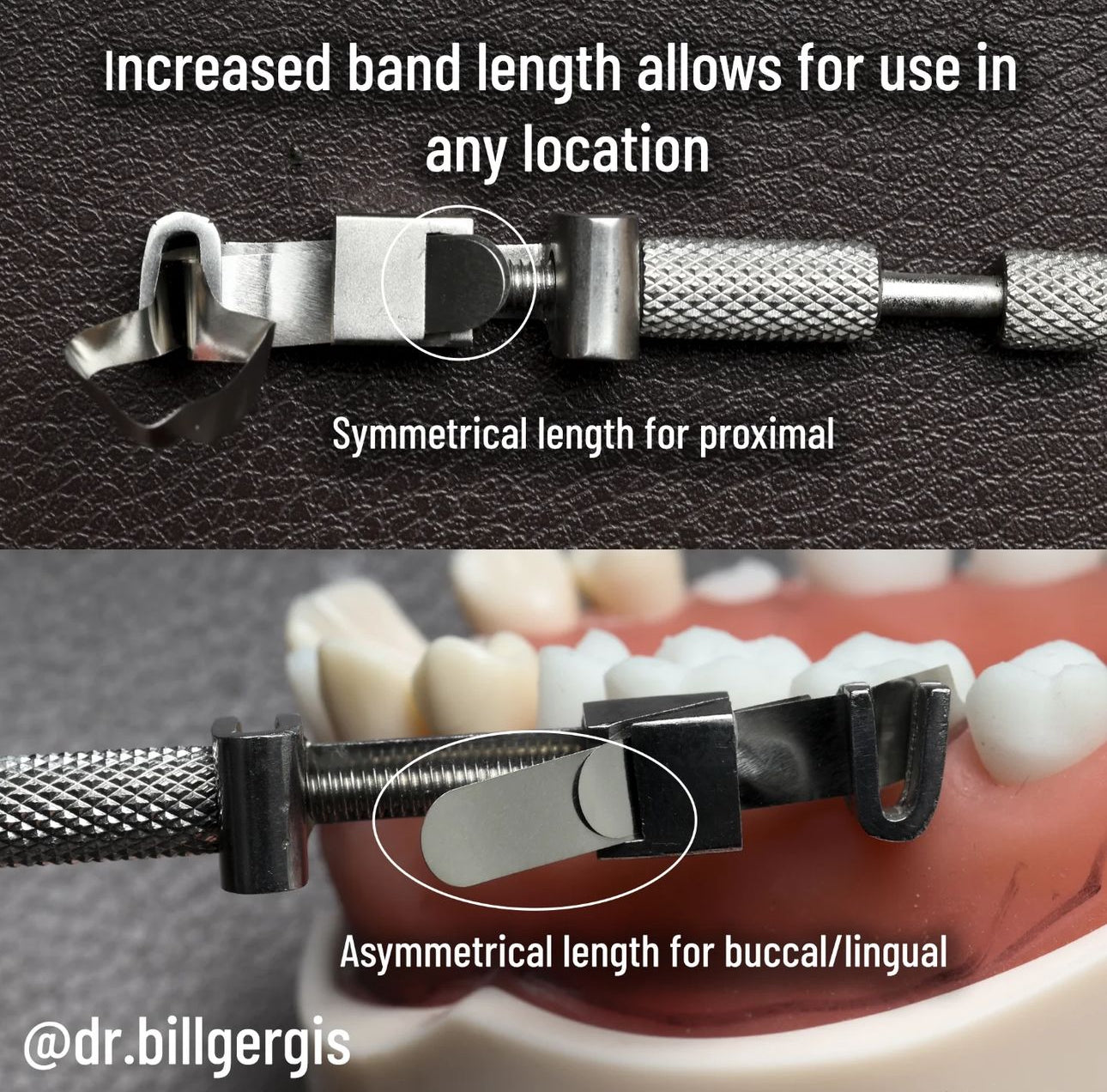 Easyinsmile Dental Metal Matrix Bands – 6mm For Molar Restoration – Tofflemire – 10pcs