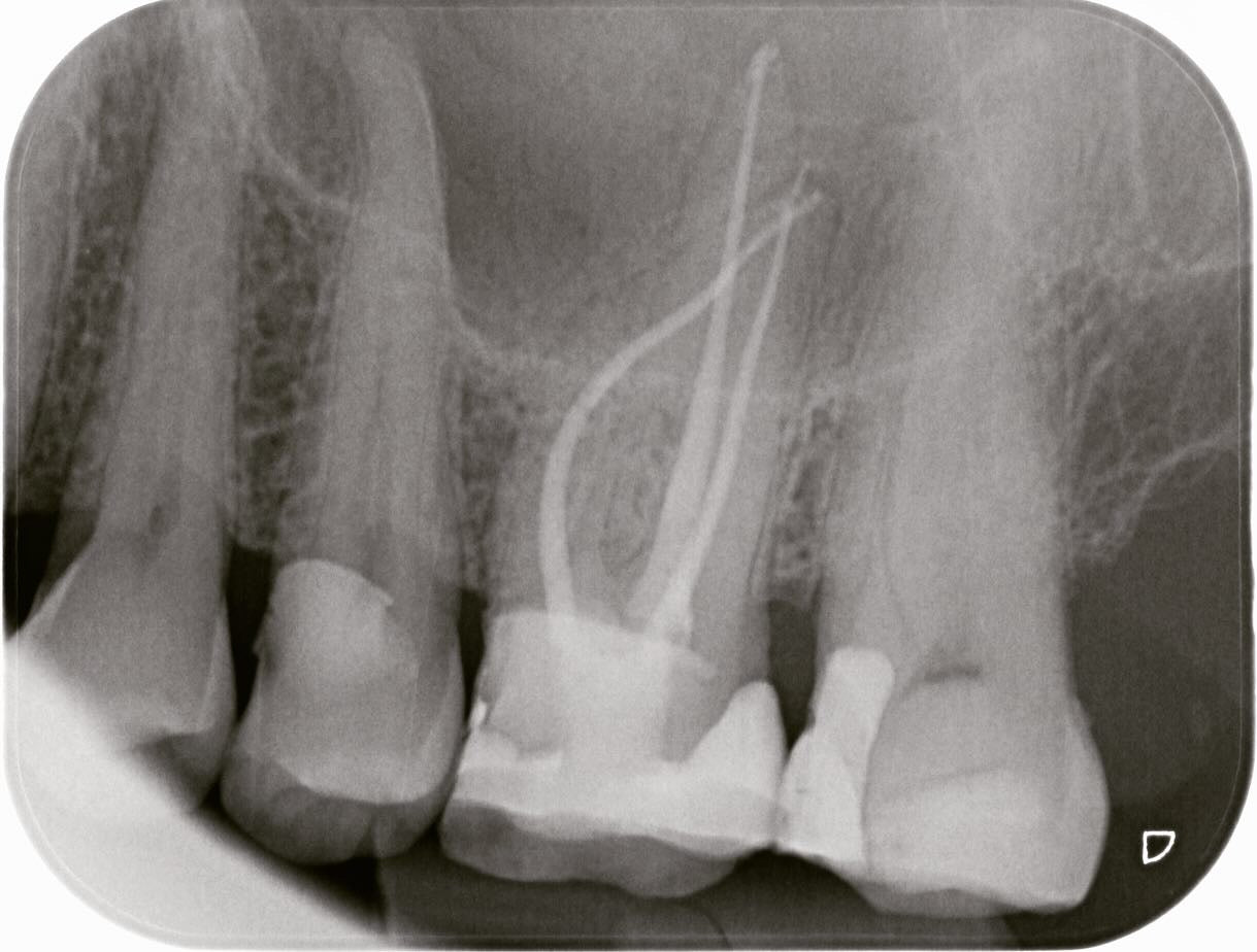 Endo-Resto with Dr Thomas Taha & Dr Daniel Flynn