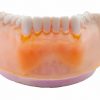 3D Training teeth