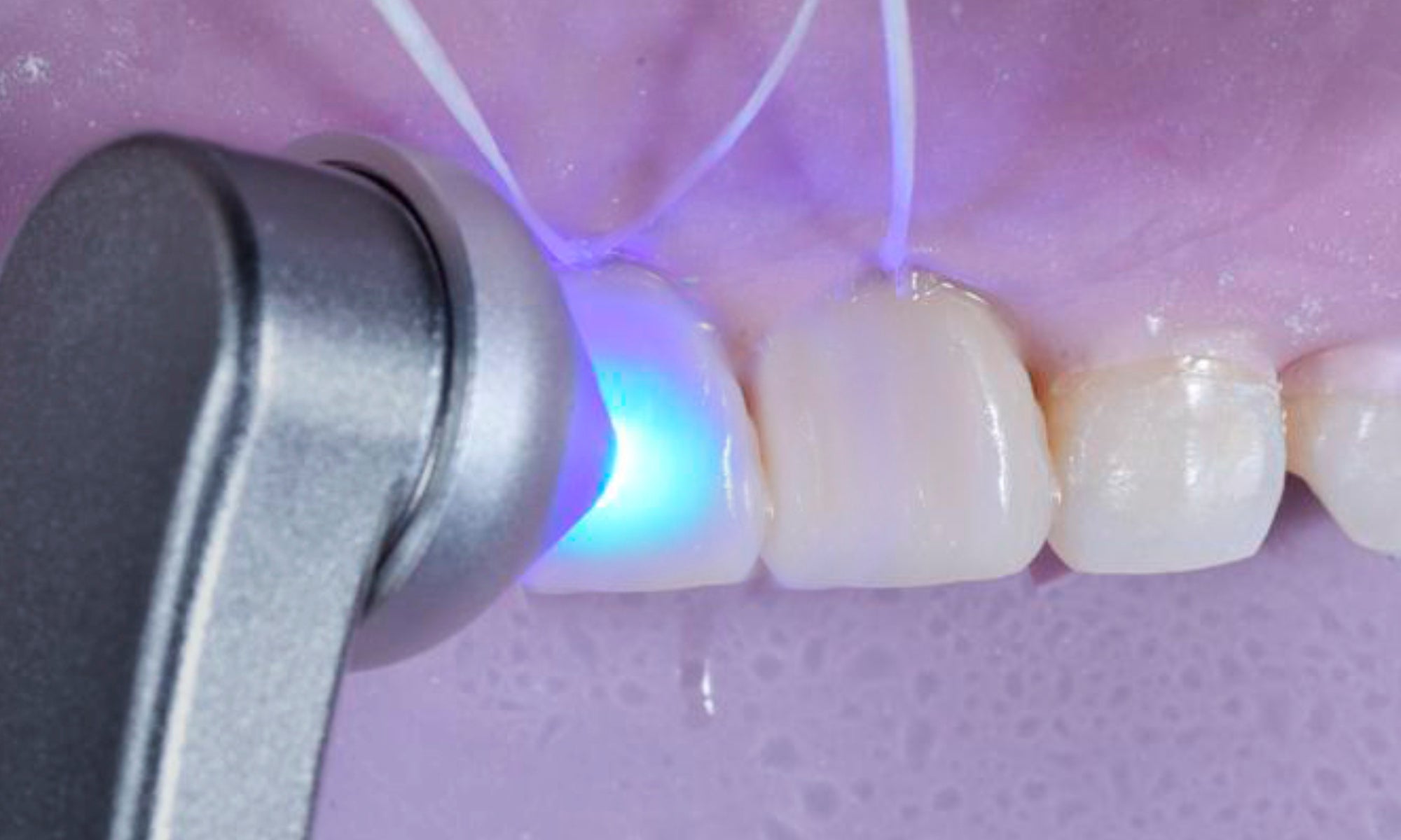 O-Light II- Curing light (preorder)