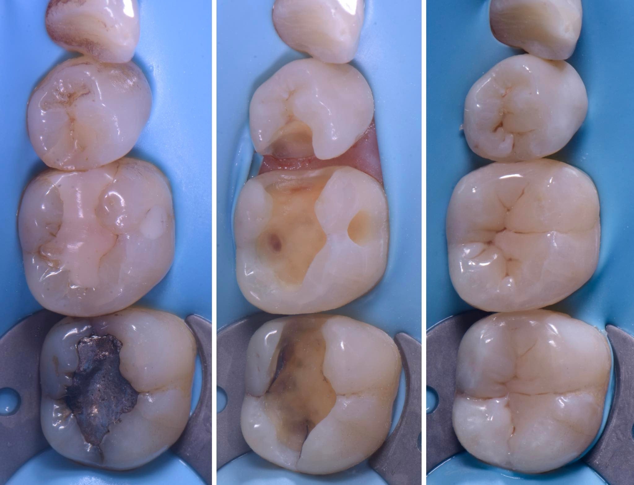 Endo-Resto with Dr Thomas Taha & Dr Daniel Flynn