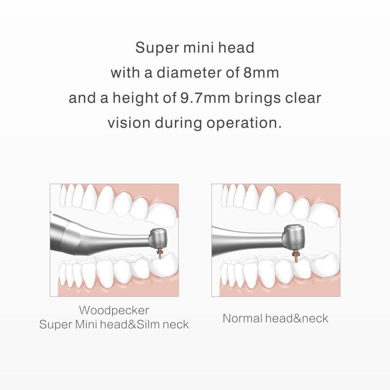 Ai Endodontic Cordless motor - toothsaver