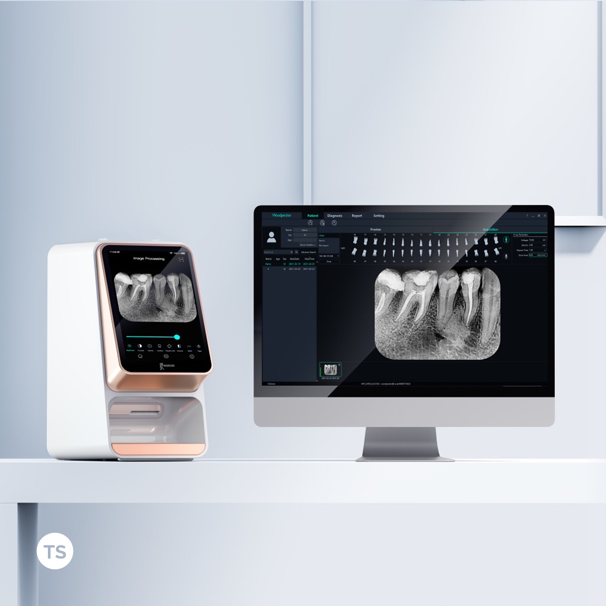 i-Scan phosphor plate system