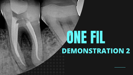 One Fil Bioceramic Root Canal Sealer
